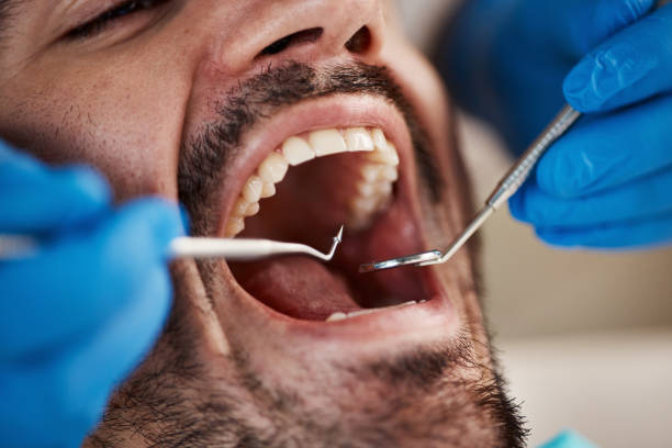 Best Emergency Dental Filling Replacement  in Lithonia, GA